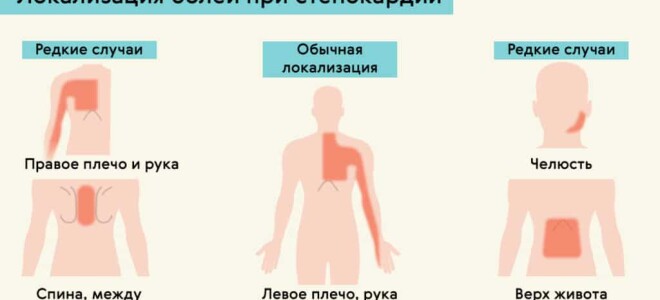 Препараты от стенокардии и инфаркта с доставкой в интернет-аптеке